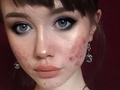#FORUM Kenapa Sih Kalau Berenti dari Krim Dokter, Kulit Wajah Jadi Makin Memburuk??