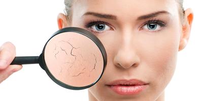 Masker arang dapat menyebabkan kulit kering