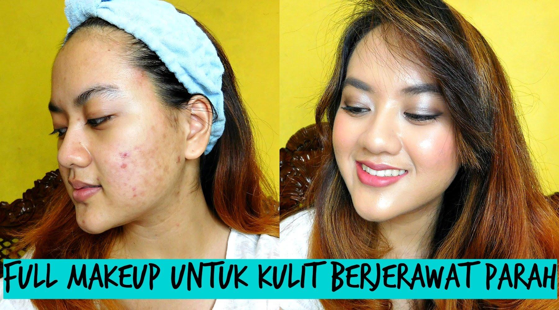 Ingin Mendapatkan Make Up Flawless Pada Kulit Wajah Berjerawat Yuk